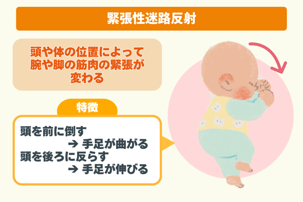 緊張性迷路反射